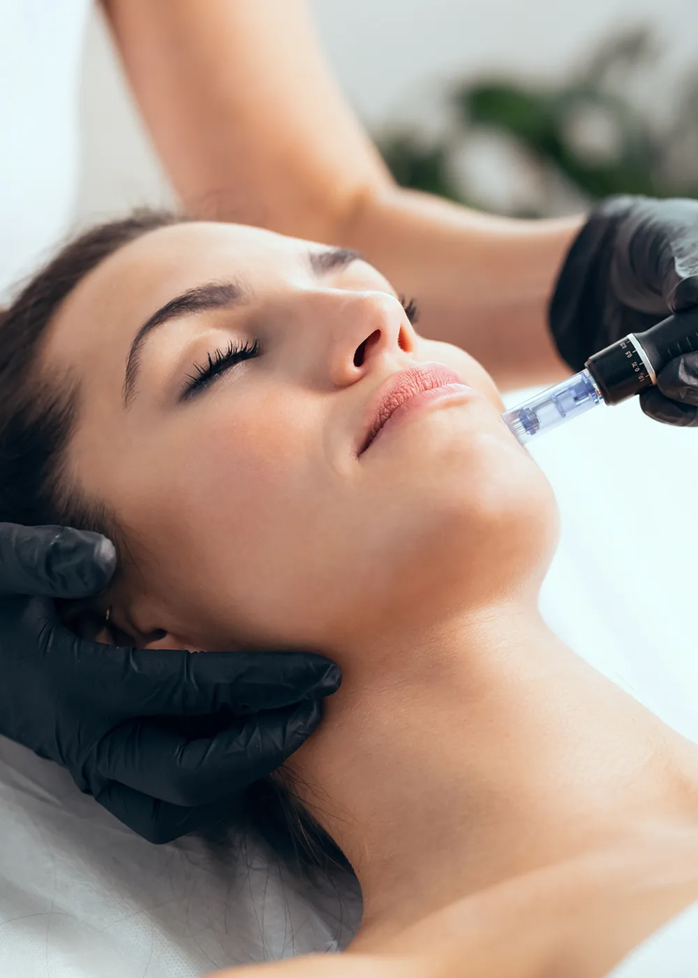 Microneedling Jelena Meyer atelier Baden Wettingenwebp