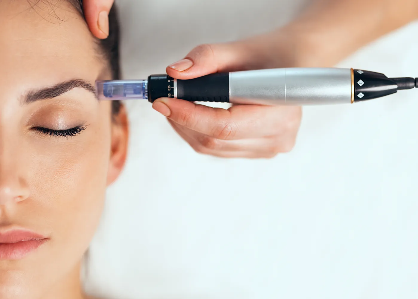 Microneedling Jelena Meyer atelier Baden Wettingen